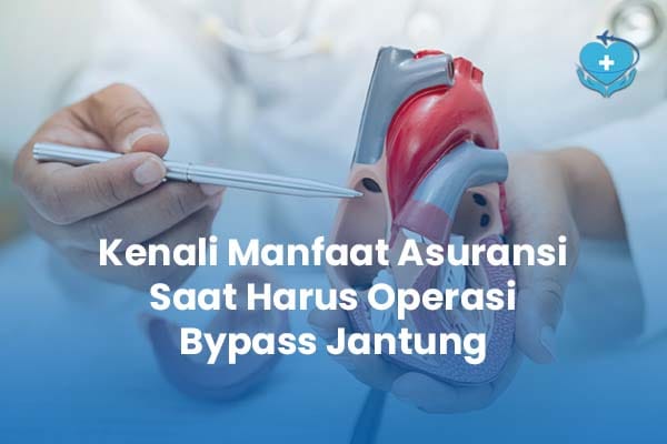 Kenali Manfaat Asuransi Saat Harus Operasi Bypass Jantung